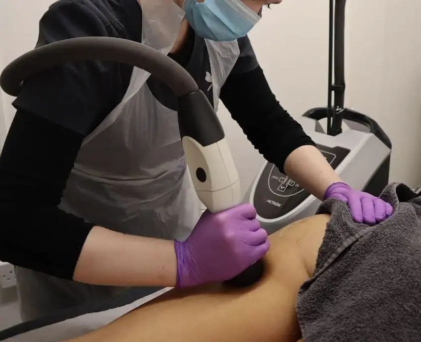 laser hair removal Dublin